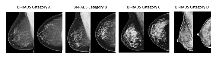 Eight side-by-side images show the appearance of breasts at each of the 4 categories of density, as described in the main text.